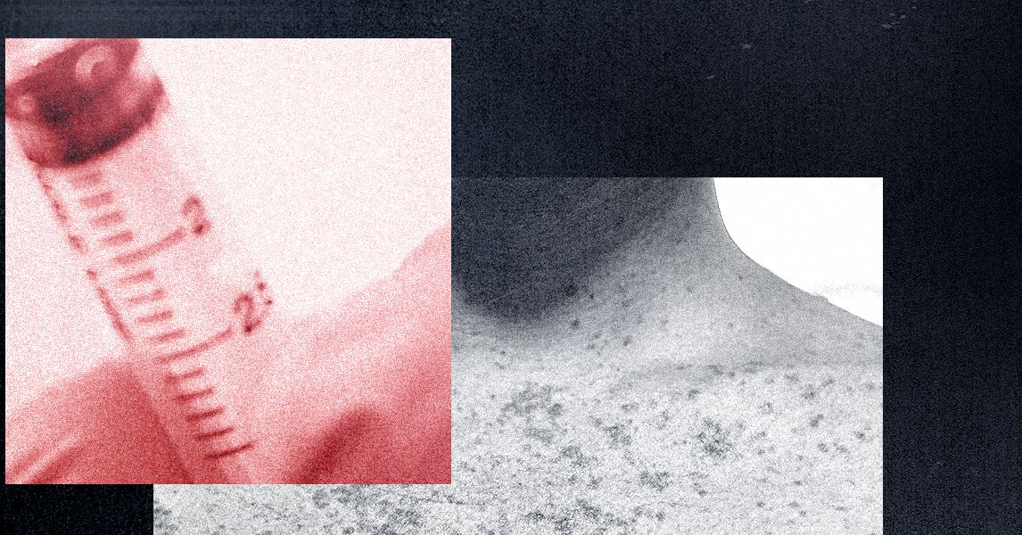 Anti-Vaxxers Are Grifting Off the Measles Outbreak—and Claim a Bioweapon Caused It