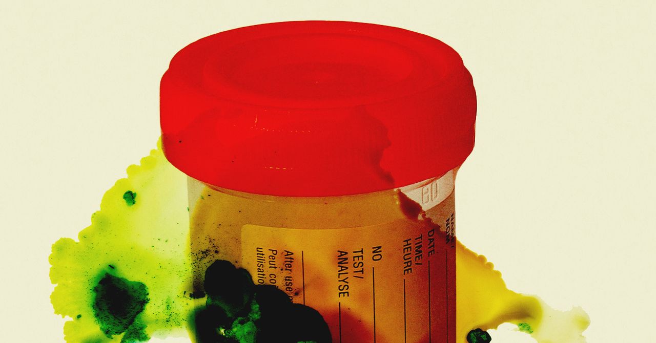 Thousands of Urine and Tissue Samples Are in Danger of Rotting After Staff Cuts at a CDC Laboratory