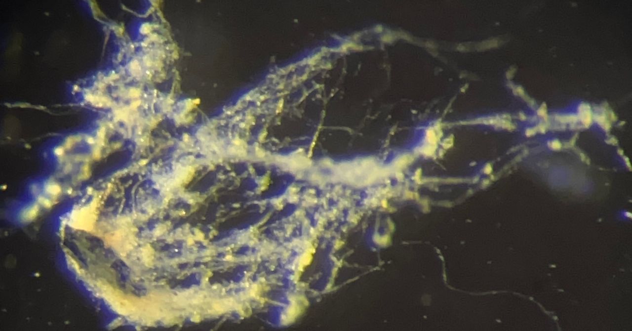 Scientists Have Just Discovered a New Type of Electricity-Conducting Bacteria