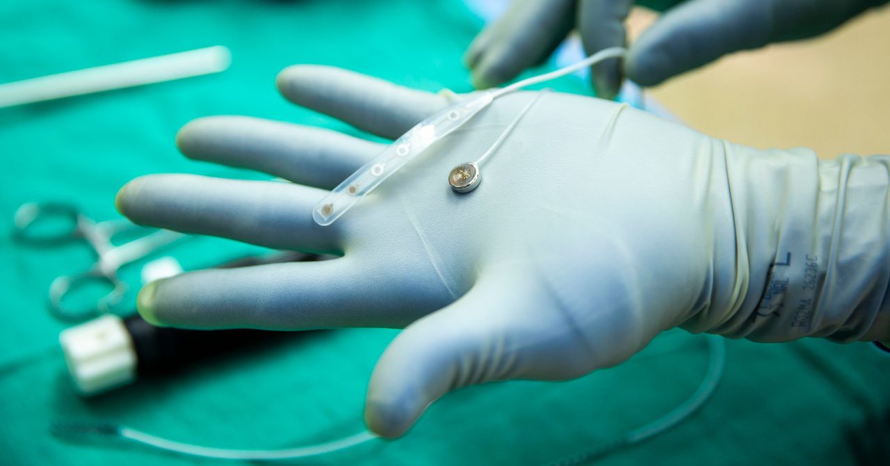 A Neuralink Rival Just Tested a Brain Implant in a Person