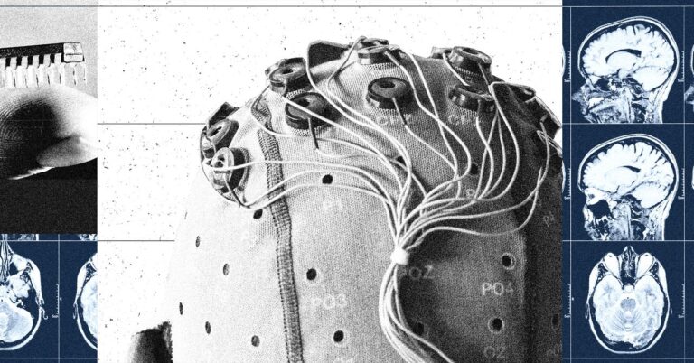 China Is Building a Brain-Computer Interface Industry