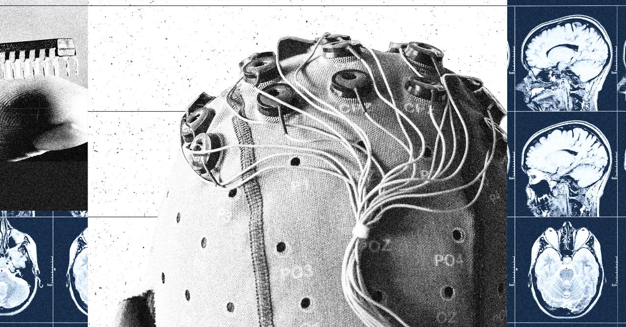 China Is Building a Brain-Computer Interface Industry